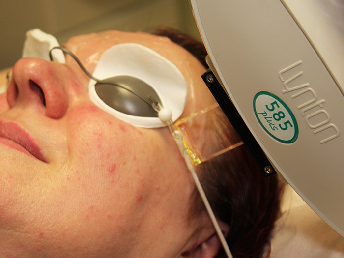 Lasers are used to reduce various skin ailments 
